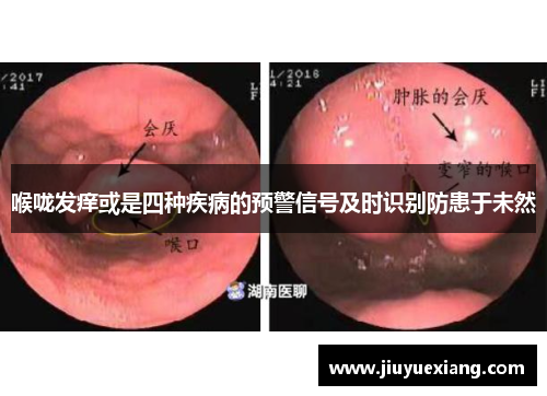 喉咙发痒或是四种疾病的预警信号及时识别防患于未然